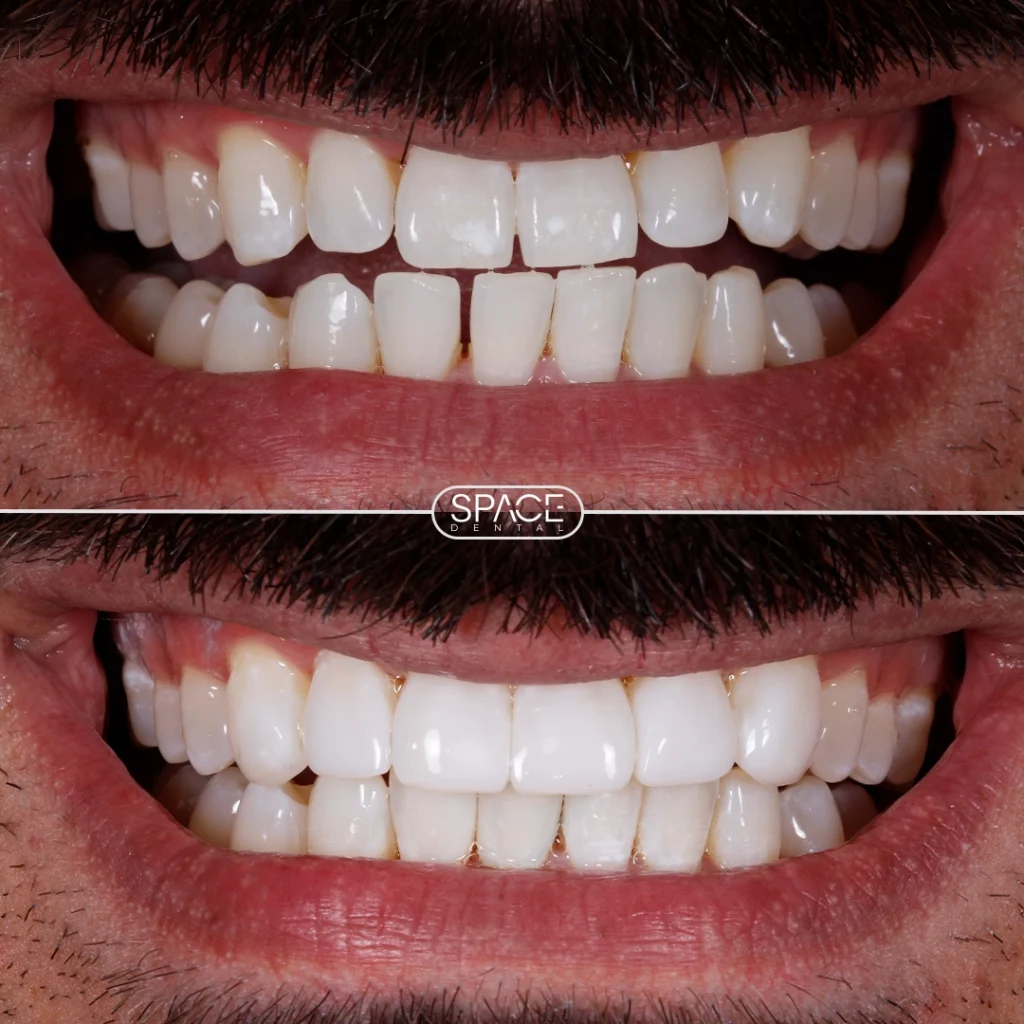 Modern orthodontic treatments at Charizma Dental Clinic