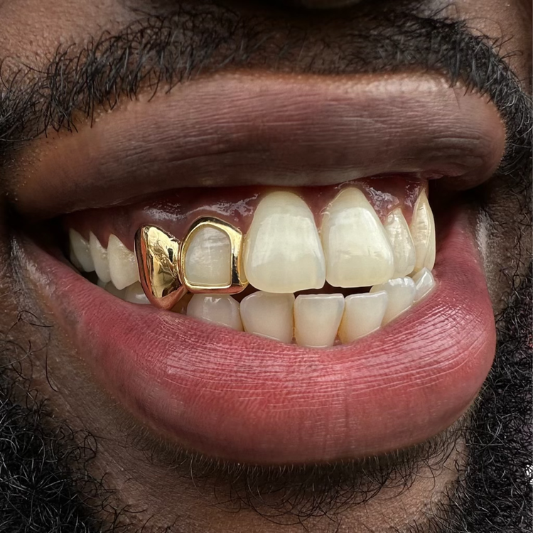 Modern orthodontic treatments at Charizma Dental Clinic