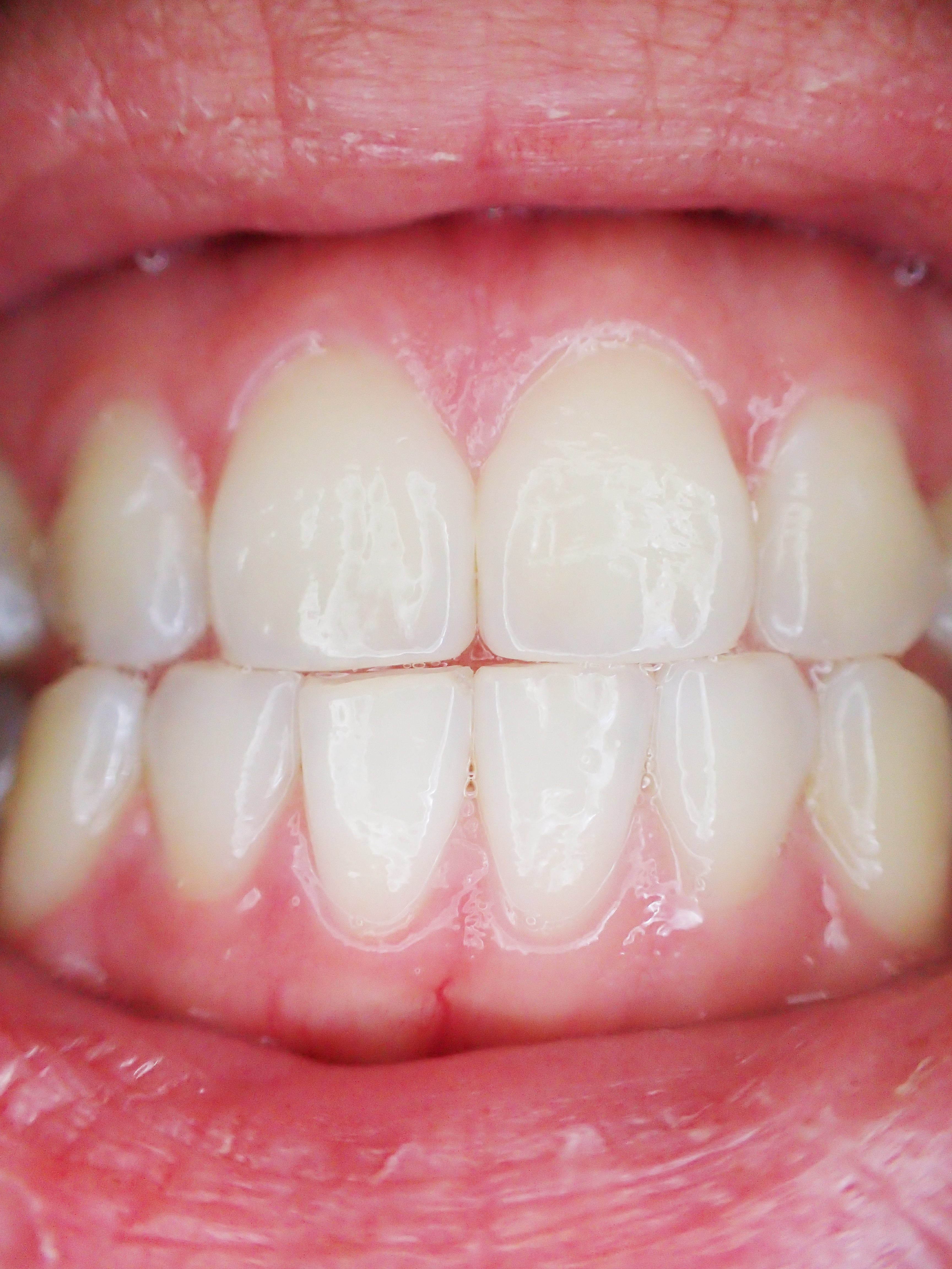 Healthy gums and teeth showing proper brushing technique