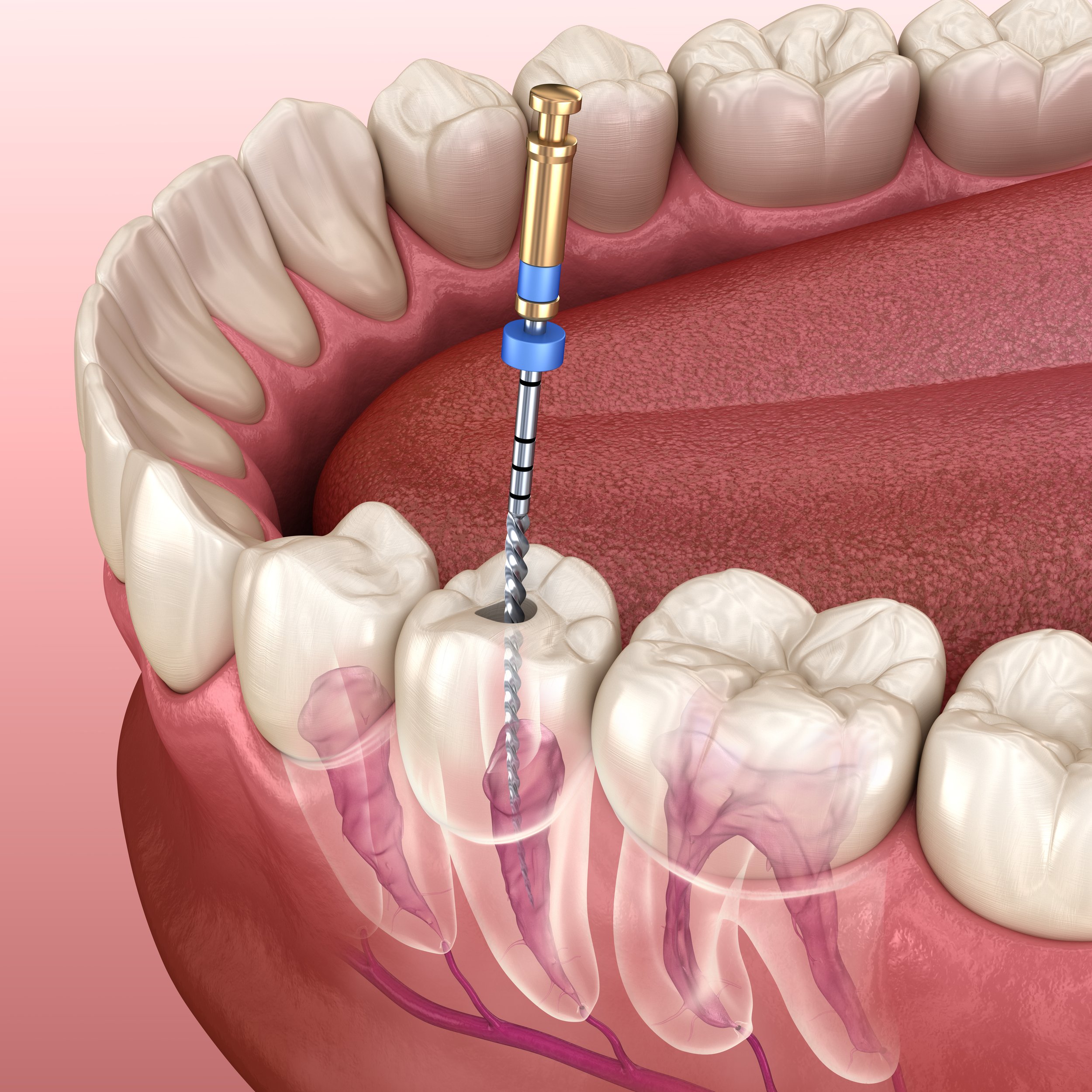 Modern orthodontic treatments at Charizma Dental Clinic