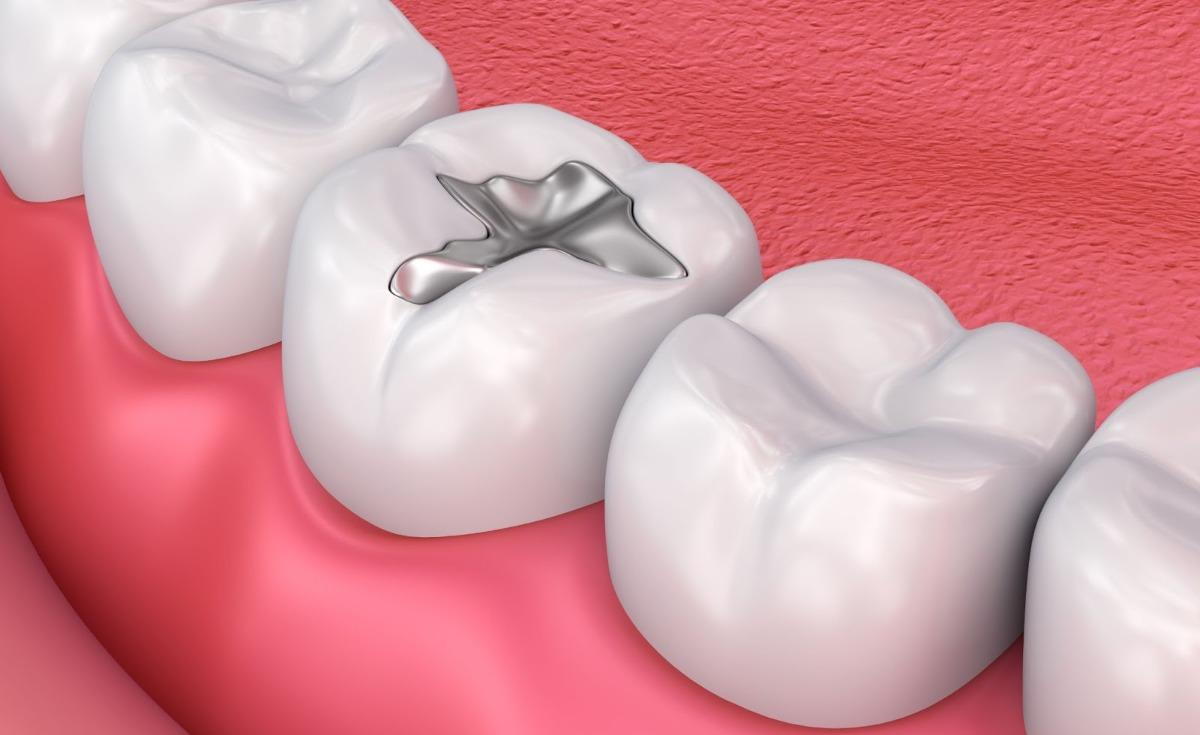 Modern orthodontic treatments at Charizma Dental Clinic