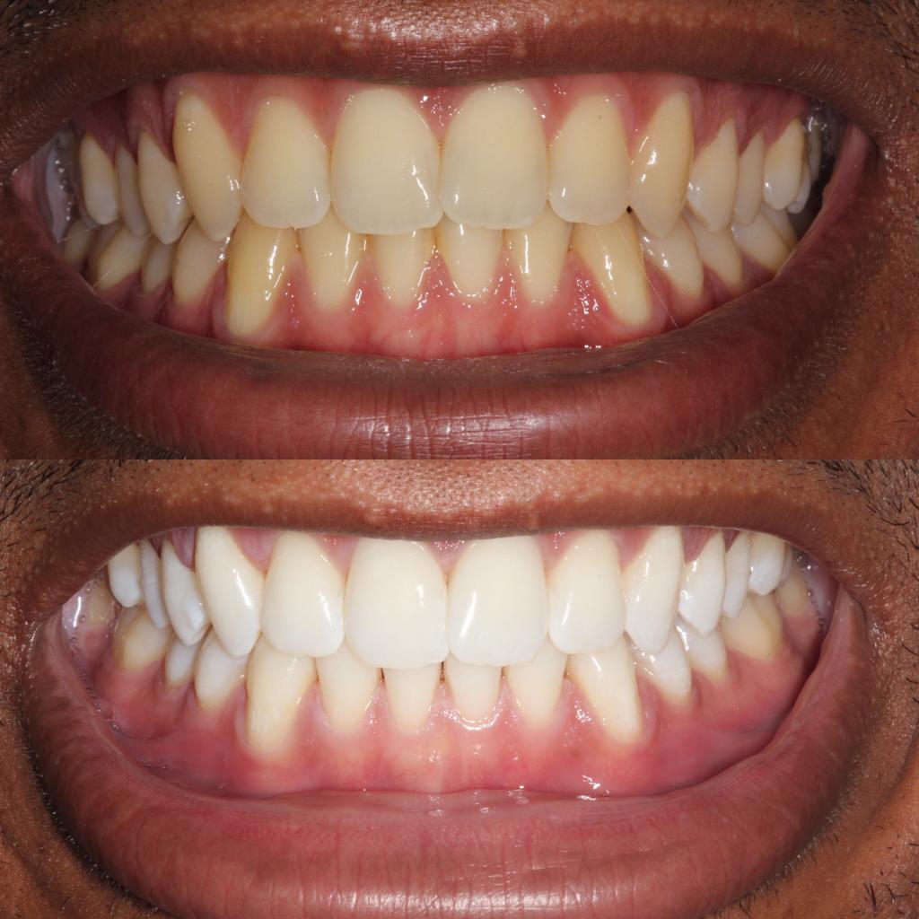 Modern orthodontic treatments at Charizma Dental Clinic
